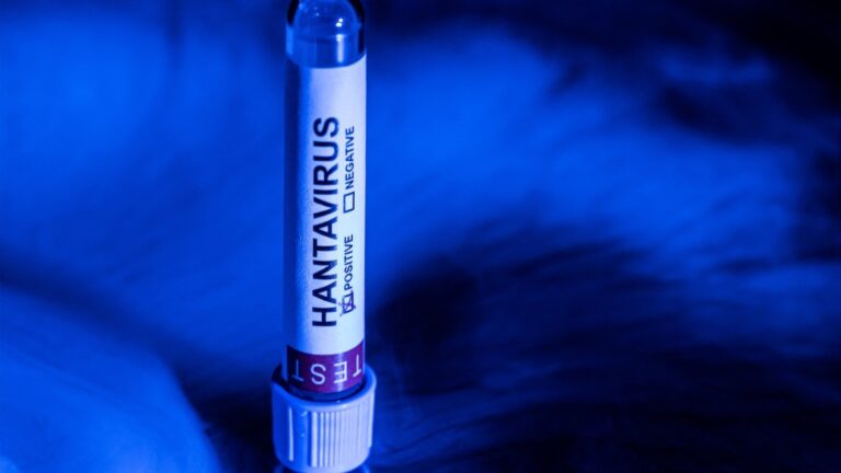 This picture taken in a studio in Paris on May 11, 2026 shows a test vial with a sticker reading "hantivirus" and a box saying "positive” checked.